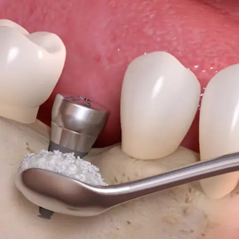Msmiline Cosmetic Dentistry