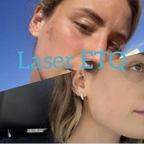 Shelly Najafi / Skin & Laser Specialist