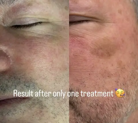 Shelly Najafi / Skin & Laser Specialist