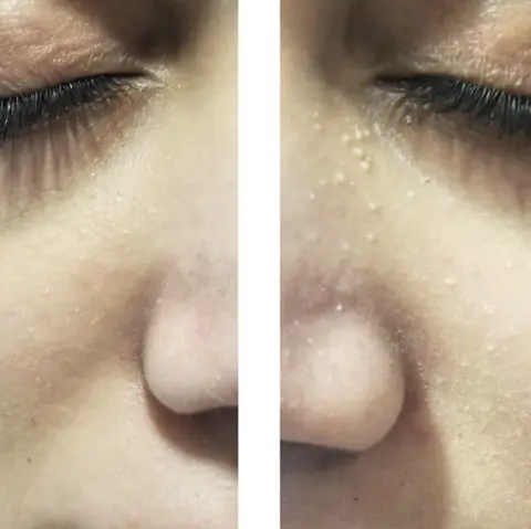 Shelly Najafi / Skin & Laser Specialist
