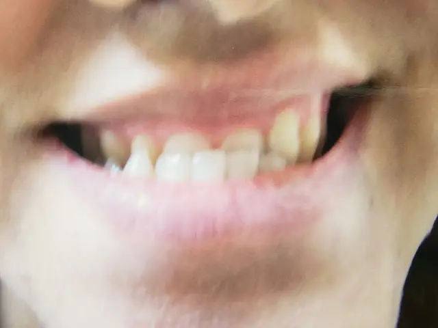 Summit Dental Centre (Dr. Mahmoud Mohebiany)